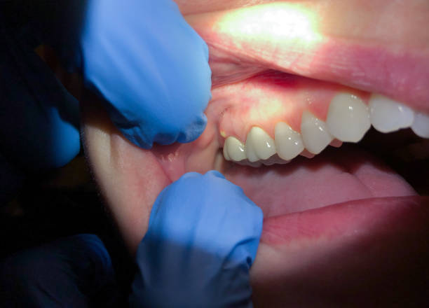 Best Same-Day Emergency Dental Services in The Village, OK