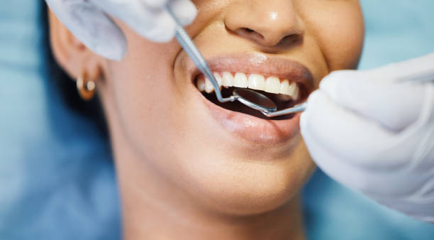 Best Emergency Dental Care for Broken or Chipped Teeth in The Village, OK