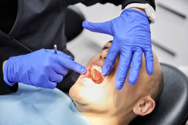 Best Emergency Root Canal Treatment in The Village, OK