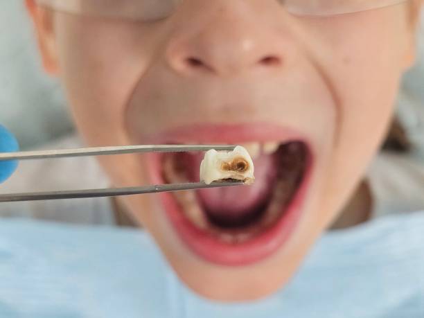 Best Emergency Dental Care for Broken or Chipped Teeth in The Village, OK