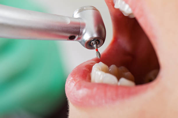 Best Emergency Dental Care for Broken or Chipped Teeth in The Village, OK